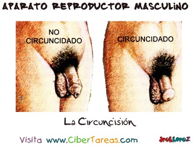 La Circuncision - Aparato Reproductor Masculino