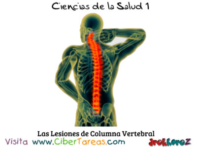 Las Lesiones de Columna Vertebral en Signos, Síntomas y Tratamientos – Ciencias de la Salud 1 1