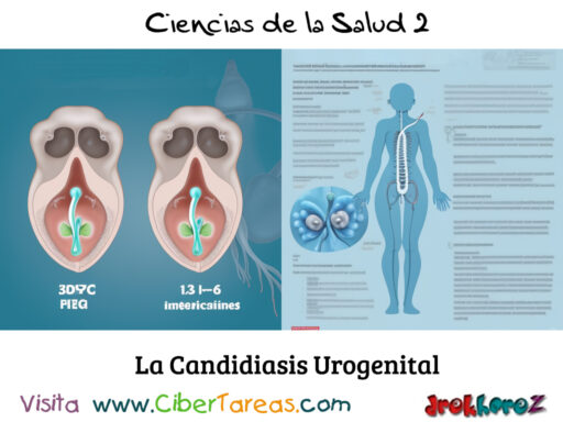 Candidiasis Urogenital – Ciencias de la Salud 2 1